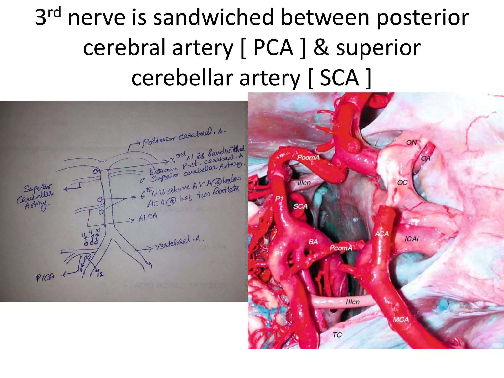 3rd nerve is sandwiched between posterior
cerebral artery [ PCA ] & superior
cerebellar artery [ SCA ]
 