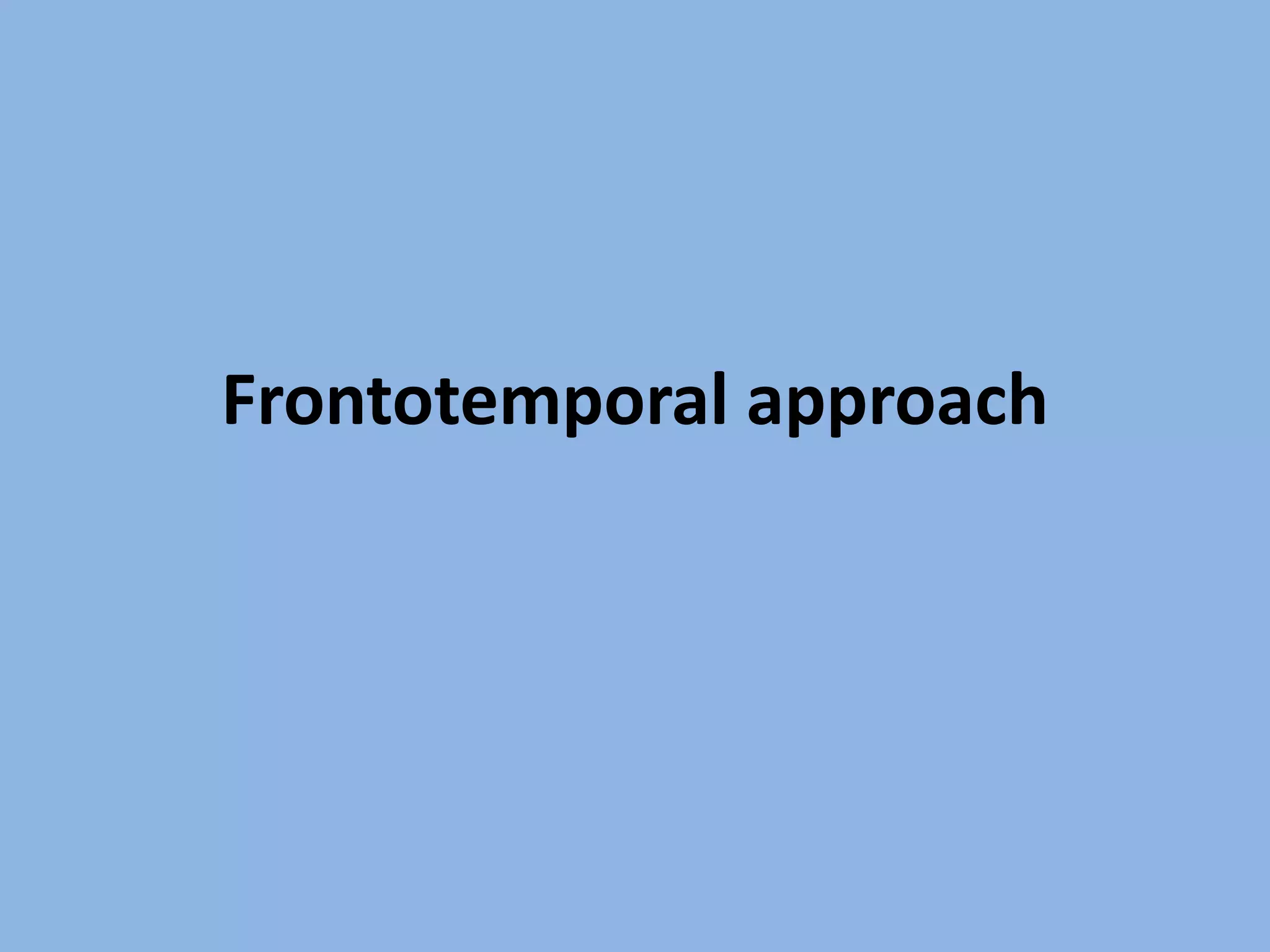 Frontotemporal approach
 