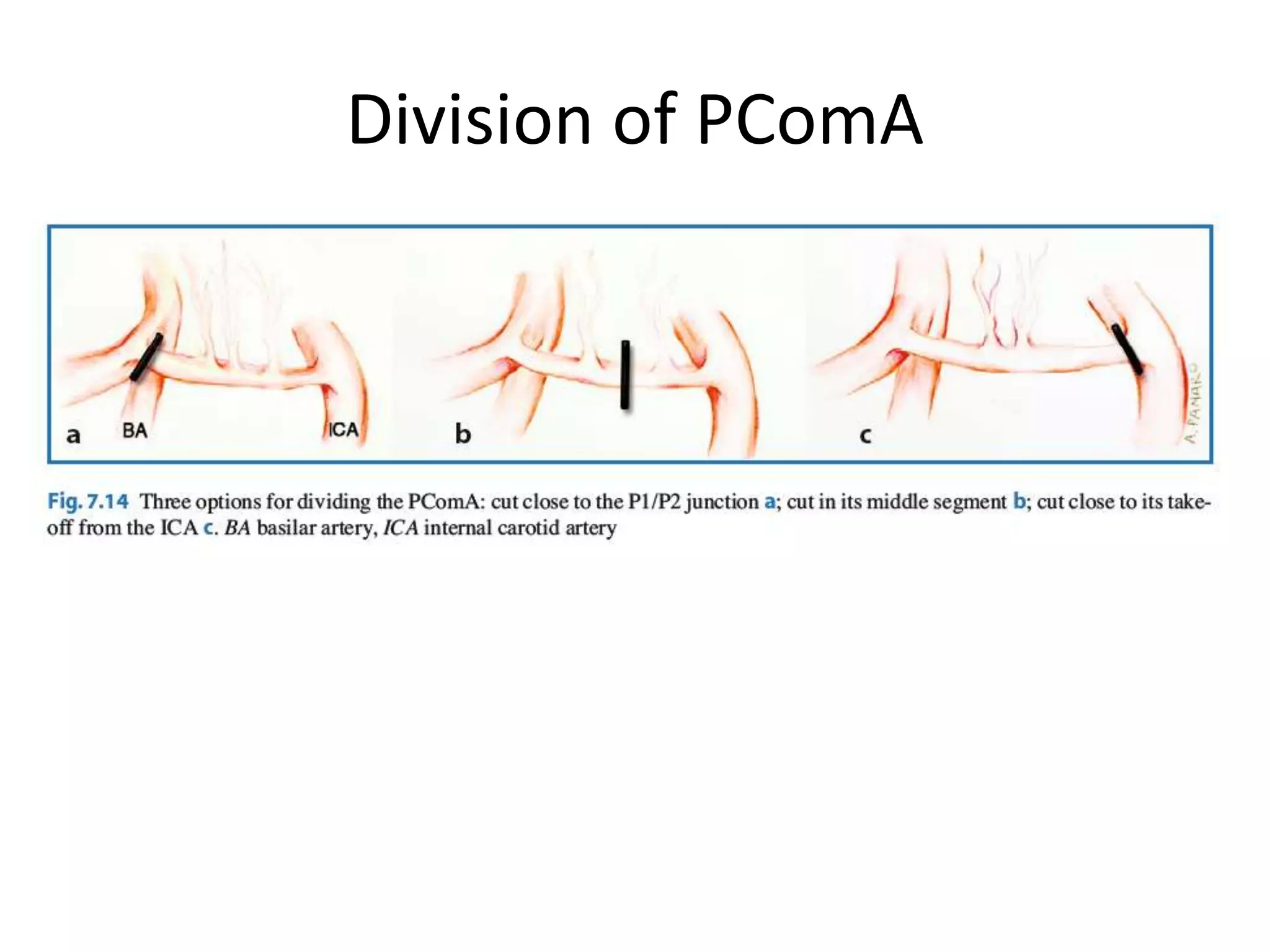 Division of PComA
 