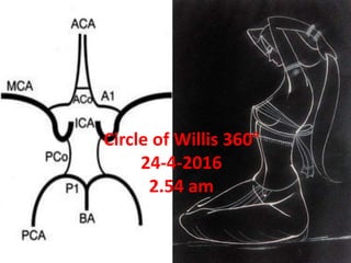 Circle of Willis 360°
24-4-2016
2.54 am
 