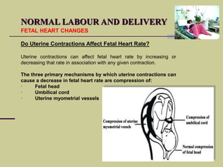 Normal labour and delivery | PPSX