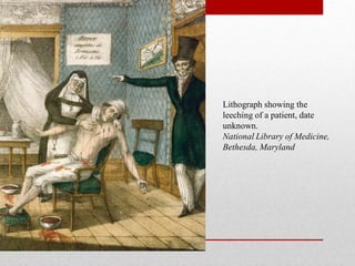 Lithograph showing the
leeching of a patient, date
unknown.
National Library of Medicine,
Bethesda, Maryland
 