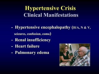 Hypertensive Crisis
Clinical Manifestations
- Hypertensive encephalopathy (H/A, N & V,
seizures, confusion, coma)
- Renal insufficiency
- Heart failure
- Pulmonary edema
 