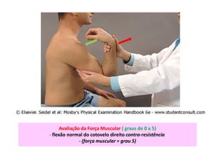 Avaliação da Força Muscular ( graus de 0 a 5)
- flexão normal do cotovelo direito contra-resistência
- (força muscular = grau 5)
 