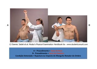 A – Procedimento = Teste de Neer
B- Procedimento = Teste de Hawkins
Condição Detectada = Ruputura ou Impacto do Manguito Rotador do Ombro
 