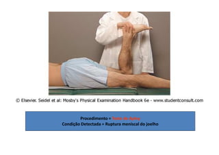 Procedimento = Teste de Apley
Condição Detectada = Ruptura meniscal do joelho
 