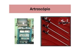 Artroscópio
 