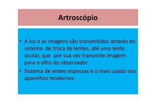 Artroscópio
• A luz e as imagens são transmitidas através do
sistema de troca de lentes, até uma lente
ocular, que por sua vez transmite imagem
para o olho do observador.
• Sistema de lentes espessas é o mais usado nos
aparelhos modernos.
 