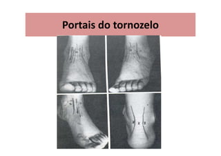 Portais do tornozelo
 