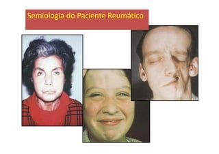 Semiologia do Paciente Reumático
 