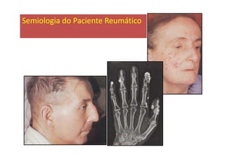 Semiologia do Paciente Reumático
 