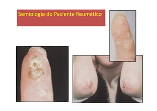 Semiologia do Paciente Reumático
 