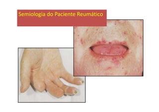Semiologia do Paciente Reumático
 