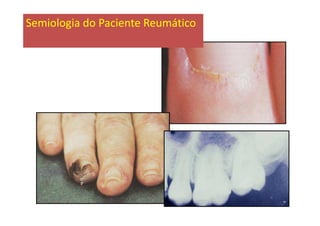 Semiologia do Paciente Reumático
 
