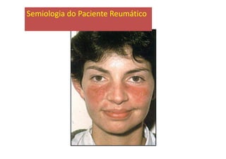 Semiologia do Paciente Reumático
 