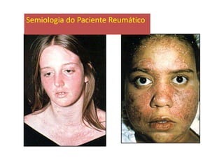 Semiologia do Paciente Reumático
 
