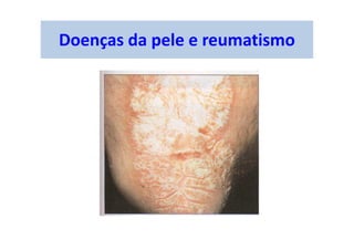Doenças da pele e reumatismo
 