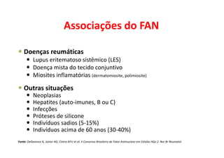 Associações do FAN
Doenças reumáticas
Lupus eritematoso sistêmico (LES)
Doença mista do tecido conjuntivo
Miosites inflamatórias (dermatomiosite, polimiosite)
Outras situações
Neoplasias
Hepatites (auto-imunes, B ou C)
Infecções
Próteses de silicone
Indivíduos sadios (5-15%)
Indivíduos acima de 60 anos (30-40%)
Fonte: Dellavence A, Júnior AG, Cintra AFU et al. II Consenso Brasileiro de Fator Antinuclear em Células HEp-2. Rev Br Reumatol
 