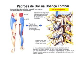 figura
Dor esclerogênica
 