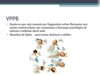 VPPB
• Supõe-se que seja causada por fragmentos soltos flutuantes nos
canais semicirculares que aumentam a descarga neurológica di
sistema vestibular deste lado.
• Manobra de Epley – para tentar deslocar o otólito.
 