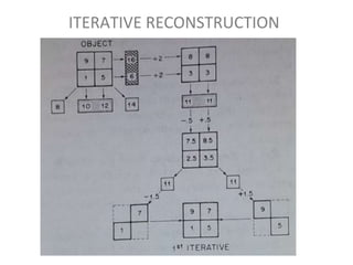 ITERATIVE RECONSTRUCTION
 