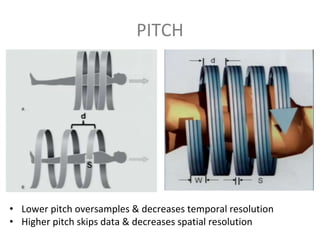 PITCH
• Lower pitch oversamples & decreases temporal resolution
• Higher pitch skips data & decreases spatial resolution
 