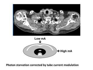 Photon starvation corrected by tube current modulation
 