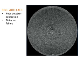RING ARTEFACT
• Poor detector
calibration
• Detector
failure
 