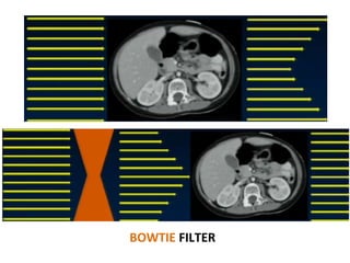 BOWTIE FILTER
 