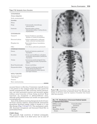 Skeletal Scintigraphy 115 
Table 7-4 Metabolic Bone Disorders 
OSTEOPOROSIS 
Primary (idiopathic) 
Senile, postmenopausal 
Secondary 
Disuse 
Drugs Corticosteroids, chemotherapy, 
anticonvulsants 
Endocrine Hyperthyroidism, primary 
hyperparathyroidism, Cushing disease, 
hypogonadism 
OSTEOMALACIA 
Vitamin D Vitamin D deficiency, hereditary 
disorders of vitamin D metabolism 
Decreased calcium Calcium malabsorption, inadequate 
intake, calcitonin secreting tumors 
Phosphate loss Renal tubular disease, hemodialysis, 
transplant 
Other Liver disease, phenytoin, prematurity 
HYPERPARATHYROIDISM 
Primary Parathyroid adenoma, parathyroid 
hyperplasia 
Secondary Chronic renal insufficiency, phosphate 
metabolism abnormalities, parathyroid 
hyperplasia 
Tertiary Autonomous parathyroid glands from 
long standing secondary hyperparathy-roidism 
Renal Osteodystrophy Chronic renal failure 
Hypoparathyroidism Iatrogenic loss/damage parathyroid 
glands during thyroidectomy; 
pseudohypoparathyroidism genetic 
end-organ resistance 
METAL TOXICITIES 
Aluminum-induced 
bone disease 
Fluorosis 
Heavy metal poisoning 
accurate history is often key. Craniotomy typically leaves 
a rim pattern at the surgical margin that may persist for 
months postoperatively. Rib retraction during thoracot-omy 
can elicit periosteal reaction and increased uptake 
without actual resection of bone being involved. Bone 
resections are recognized as photon-deficient areas, 
although small laminectomies are usually not appreciated 
scintigraphically. 
Areas of the skeleton receiving therapeutic levels of exter-nal 
beam ionizing radiation characteristically demonstrate 
geometrical decreased uptake within 6 months to 1 year 
after therapy (Figs. 7-12 and 7-17). The mechanism is prob-ably 
decreased osteogenesis and decreased blood flow to 
postirradiated bone. 
Child Abuse 
The generally high sensitivity of skeletal scintigraphy 
would seem to make it an ideal survey test in cases of 
A 
B 
Figure 7-28. Osteomalacia. Anterior (A) and posterior (B) views. The 
patient was referred to rule out metastatic disease. The unusually large 
number of rib lesions raised the suspicion of metabolic bone disease 
rather than metastases. 
Box 7-9. Distribution of Increased Skeletal Uptake 
in Hyperparathyroidism 
Diffuse axial 
Periarticular 
Skull 
Mandible, fascial 
bones 
Costochondral 
­junctions 
Sternum 
Lungs 
Stomach 
 