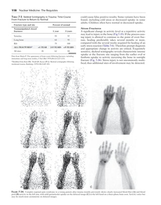118 Nuclear Medicine: The Requisites 
could cause false positive results. Some variants have been 
found, including cold areas or decreased uptake in some 
adults. Children often have normal or decreased uptake. 
Stress Fractures 
A significant change in activity level or a repetitive activity 
may lead to injury to the bone (Fig 7-35). If the process caus-ing 
injury is allowed to continue to the point of overt frac-ture, 
healing predictably takes several months or more, 
compared with the several weeks required for healing of an 
early stress reaction (Table 7-6). Therefore prompt diagnosis 
and appropriate change in activity are critical. Exquisitely 
sensitive, skeletal scintigraphy reveals characteristic intense 
uptake at the fracture site ranging from the earlier oval or 
fusiform uptake to activity traversing the bone in outright 
fracture (Fig. 7-36). Stress injury is not uncommonly multi-focal; 
thus additional sites of involvement may be detected. 
Table 7-5 Skeletal Scintigraphy in Trauma: Time Course 
From Fracture to Return to Normal 
Fracture type and site Percent of normal 
Nonmanipulated closed 
fractures 1 year 3 years 
Vertebra 59 97 
Long bone 64 95 
Rib 79 100 
ALL FRACTURES* <1 YEAR 2-5 YEARS >5 YEARS 
All sites 30 62 84 
Data from Matin P. The appearance of bone scans following fractures, including 
immediate and long term studies, J Nucl Med. 1979;20(12):1227-1231. 
*Modified from Kim HR, Thrall JH, Keyes JW Jr. Skeletal scintigraphy following 
incidental trauma, Radiology. 1979;130(2):447-451. 
A 
B 
C 
Figure 7-34. Complex regional pain syndrome in a young patient after trauma months previously shows clearly increased blood flow (A) and blood 
pool (B) activity in the left arm, with mild periarticular uptake on the delayed image (C) in the left hand on a three-phase bone scan. Activity varies but 
may be much more asymmetric on delayed images. 
 