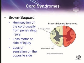 Cord Syndromes
• Brown-Sequard
• Hemisection of
the cord usually
from penetrating
injury
• Loss motor on
side of injury
• Loss of
sensation on the
opposite side
Image found on Wikimedia.org
 