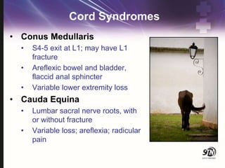 Cord Syndromes
• Conus Medullaris
• S4-5 exit at L1; may have L1
fracture
• Areflexic bowel and bladder,
flaccid anal sphincter
• Variable lower extremity loss
• Cauda Equina
• Lumbar sacral nerve roots, with
or without fracture
• Variable loss; areflexia; radicular
pain
 