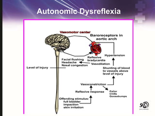 Autonomic Dysreflexia
 