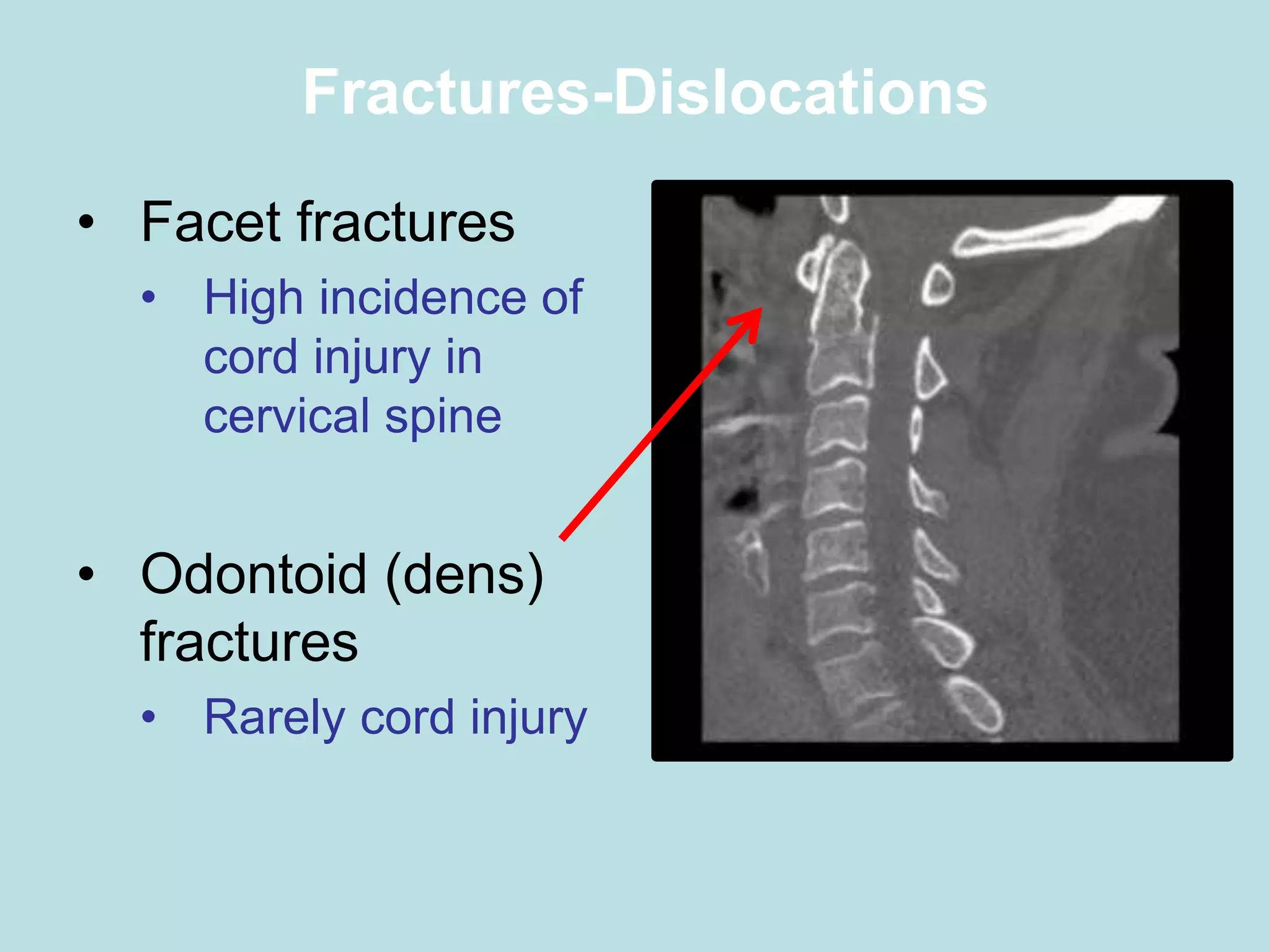 7_Spinal Column and Spinal Cord Injuries (1).pptx