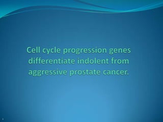 Cell cycle progression genes differentiate indolent from aggressive prostate cancer. 1 1 