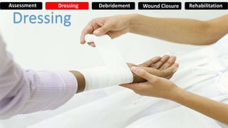 Dressing
Assessment Dressing Debridement Wound Closure Rehabilitation
 