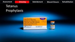Tetanus
Prophylaxis
Assessment Dressing Debridement Wound Closure Rehabilitation
 
