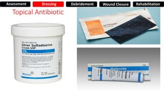 Topical Antibiotic
Assessment Dressing Debridement Wound Closure Rehabilitation
 