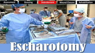 Assessment Dressing Debridement Wound Closure Rehabilitation
 