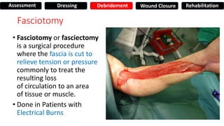 Fasciotomy
• Fasciotomy or fasciectomy
is a surgical procedure
where the fascia is cut to
relieve tension or pressure
commonly to treat the
resulting loss
of circulation to an area
of tissue or muscle.
• Done in Patients with
Electrical Burns
Assessment Dressing Debridement Wound Closure Rehabilitation
 