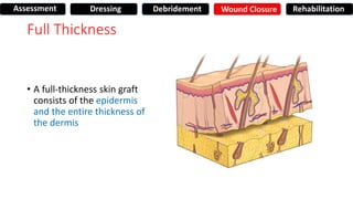 Full Thickness
• A full-thickness skin graft
consists of the epidermis
and the entire thickness of
the dermis
Assessment Dressing Debridement Wound Closure Rehabilitation
 