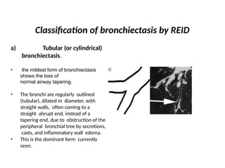 Syndrome of pathological bronchial dilation.pptx