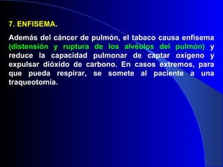 7. ENFISEMA.
Además del cáncer de pulmón, el tabaco causa enfisema
(distensión y ruptura de los alvéolos del pulmón) y
reduce la capacidad pulmonar de captar oxígeno y
expulsar dióxido de carbono. En casos extremos, para
que pueda respirar, se somete al paciente a una
traqueotomía.
 