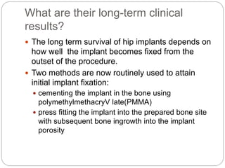 What are their long-term clinical
results?
 The long term survival of hip implants depends on
how well the implant becomes fixed from the
outset of the procedure.
 Two methods are now routinely used to attain
initial implant fixation:
 cementing the implant in the bone using
polymethylmethacryV late(PMMA)
 press fitting the implant into the prepared bone site
with subsequent bone ingrowth into the implant
porosity
 