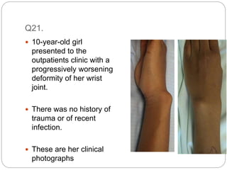 Q21.
 10-year-old girl
presented to the
outpatients clinic with a
progressively worsening
deformity of her wrist
joint.
 There was no history of
trauma or of recent
infection.
 These are her clinical
photographs
 