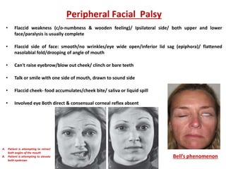 Peripheral Facial Palsy
• Flaccid weakness (c/o-numbness & wooden feeling)/ Ipsilateral side/ both upper and lower
face/paralysis is usually complete
• Flaccid side of face: smooth/no wrinkles/eye wide open/inferior lid sag (epiphora)/ flattened
nasolabial fold/drooping of angle of mouth
• Can't raise eyebrow/blow out cheek/ clinch or bare teeth
• Talk or smile with one side of mouth, drawn to sound side
• Flaccid cheek- food accumulates/cheek bite/ saliva or liquid spill
• Involved eye Both direct & consensual corneal reflex absent
Bell’s phenomenon
A. Patient is attempting to retract
both angles of the mouth
B. Patient is attempting to elevate
both eyebrows
 