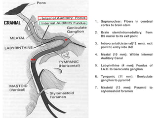 1. Supranuclear: Fibers in cerebral
cortex to brain stem
2. Brain stem/intramedullary: from
BS nuclei to its exit point
3. Intra-cranial/cisternal(12 mm): exit
point to entry into IAC
4. Meatal (10 mm): Within Internal
Auditory Canal
5. Labyrinthine (4 mm): Fundus of
I.A.C. to Geniculate ganglion
6. Tympanic (11 mm): Geniculate
ganglion to pyramid
7. Mastoid (13 mm): Pyramid to
stylomastoid foramen
*
**
 