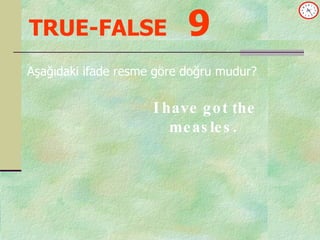 TRUE-FALSE   9 Aşağıdaki ifade resme göre doğru mudur? I have got the measles. 