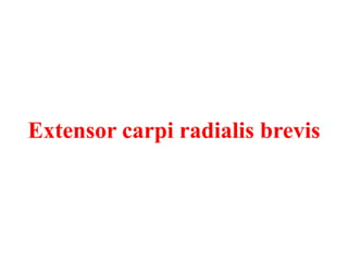 Extensor carpi radialis brevis

 